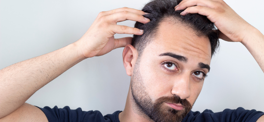 LOS MEJORES CONSEJOS PARA EVITAR LA CAÍDA DE CABELLO