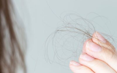 ALOPECIA: Qué es, causas y tratamientos
