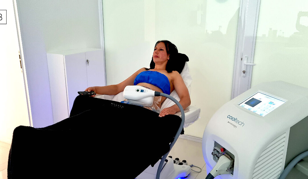 Cooltech Define: Criolipólisis para reducir grasa corporal