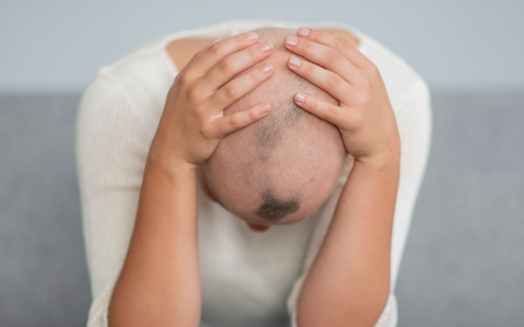 Alopecia y Autoestima: Un vínculo muy profundo