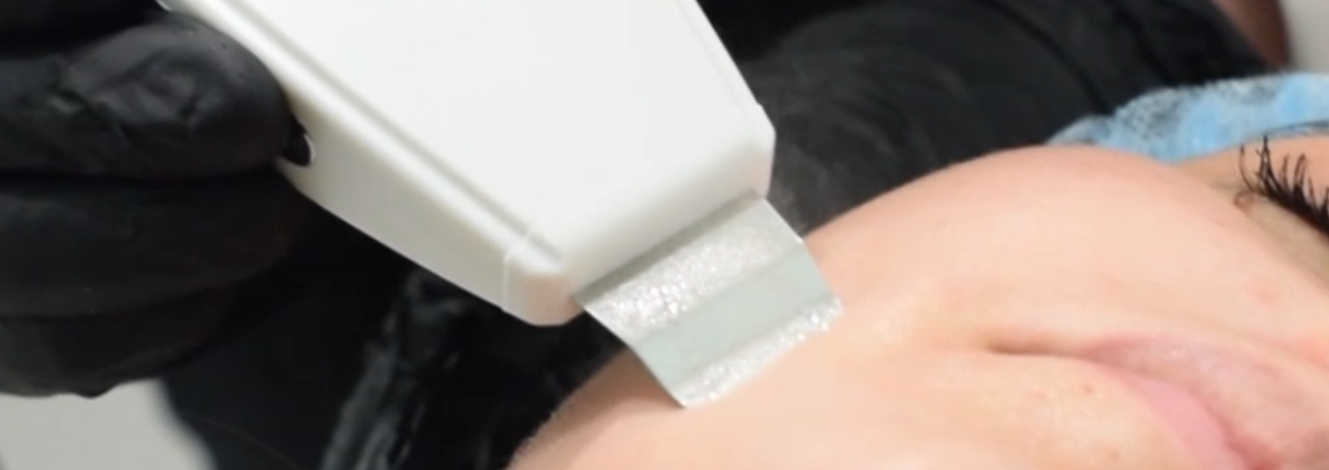 limpieza ultrasonica facial