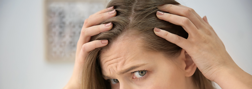 tratamientos para alopecia femenina